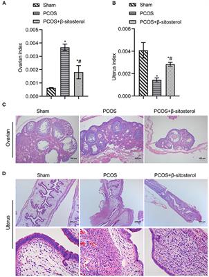 β-Sitosterol Ameliorates Endometrium Receptivity in PCOS-Like Mice: The Mediation of Gut Microbiota